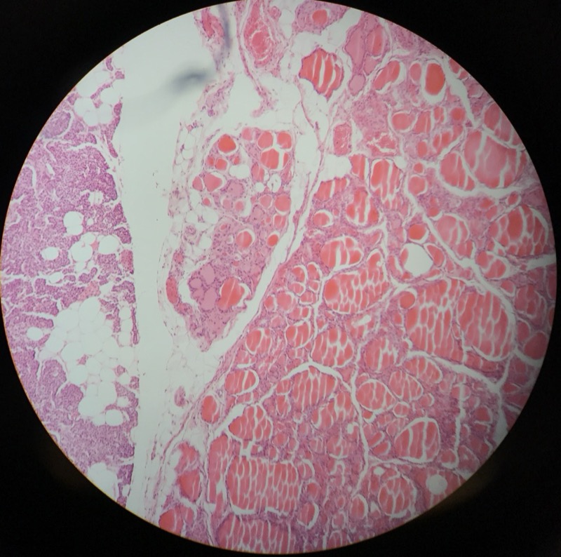 Parathyroidea - bild 5
