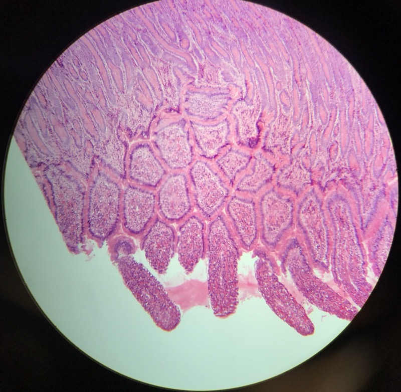 Duodenum - bild 6