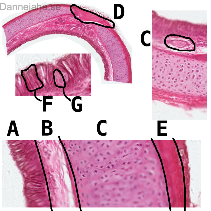 Trachea - bild 1