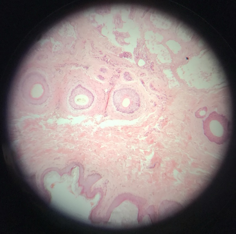 Hud pigmenterad - bild 2