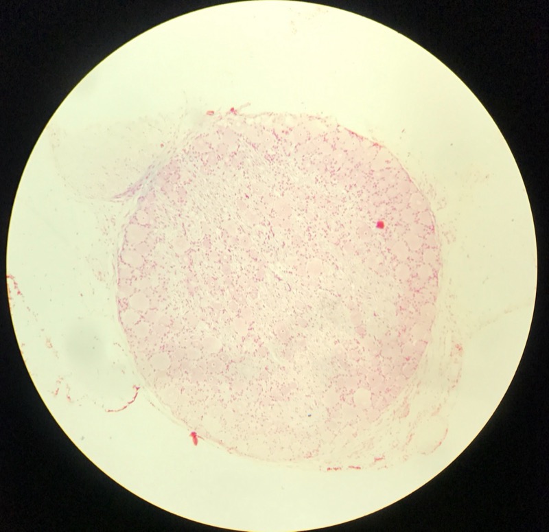 Spinalt Ganglion - bild 3