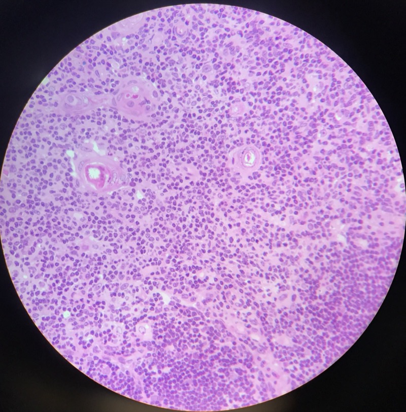Thymus - bild 3