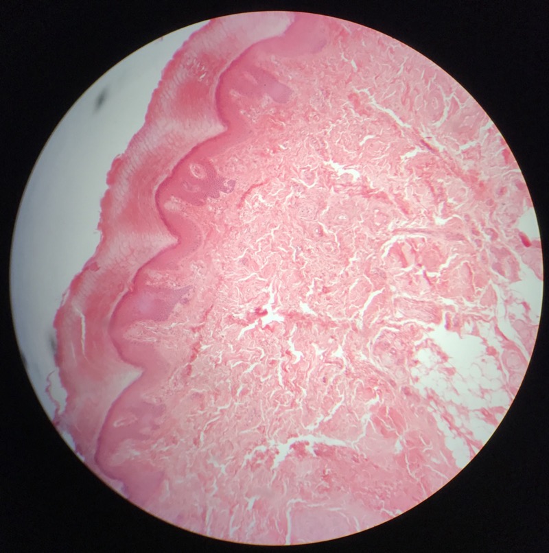 Hud med Vater Paccinis - bild 3