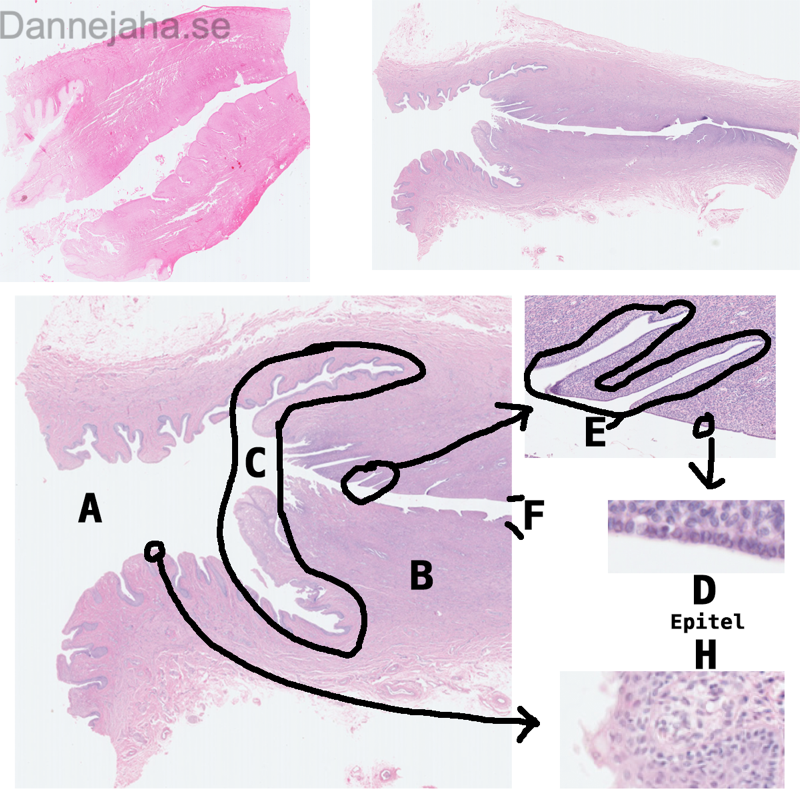 Cervix - bild 1