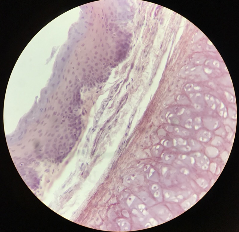 Elastiskt Brosk Epiglottis - bild 4