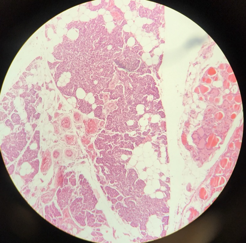 Parathyroidea - bild 3