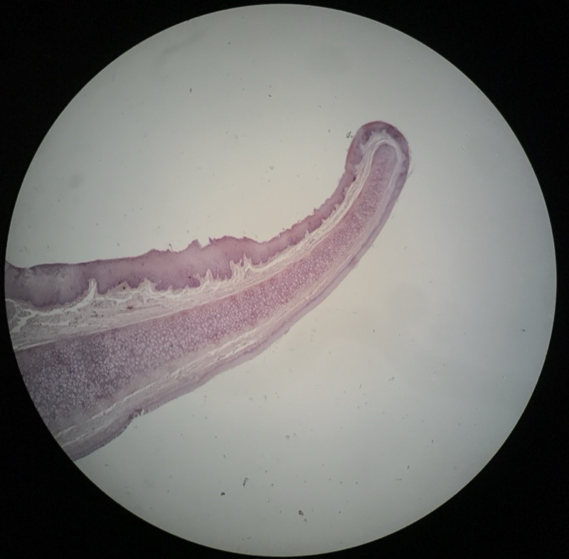 Elastiskt Brosk Epiglottis - bild 1