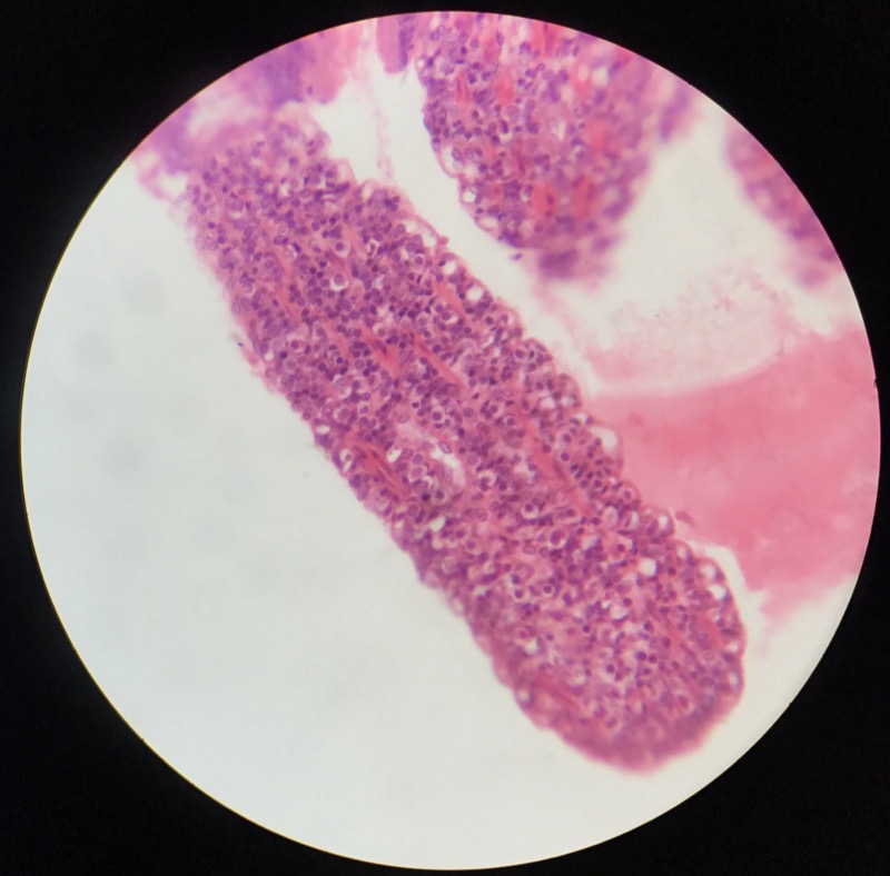 Duodenum - bild 4