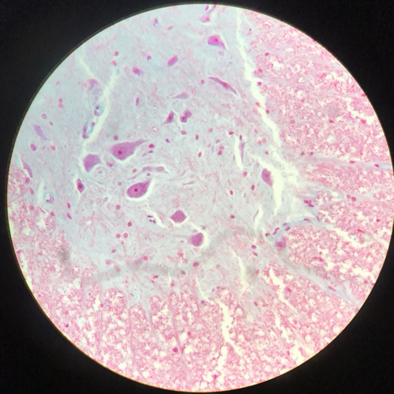 Medulla Spinalis Galiomycin/Azan - bild 2