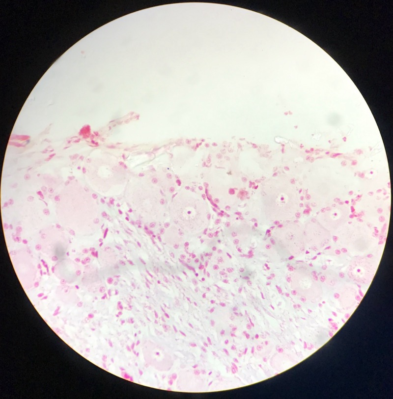 Spinalt Ganglion - bild 2