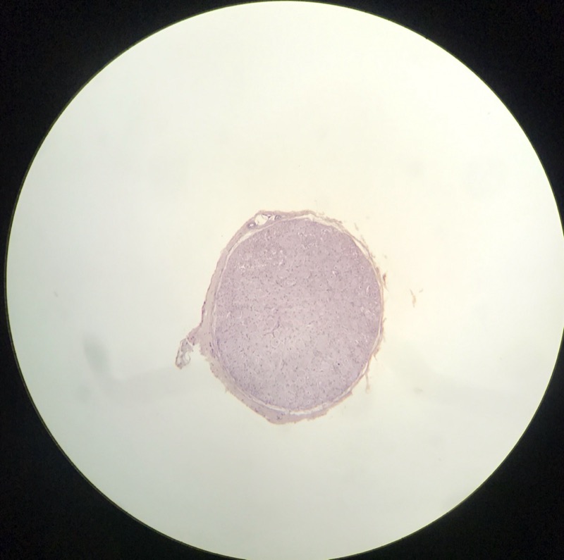 Sympatiskt Ganglion - bild 2
