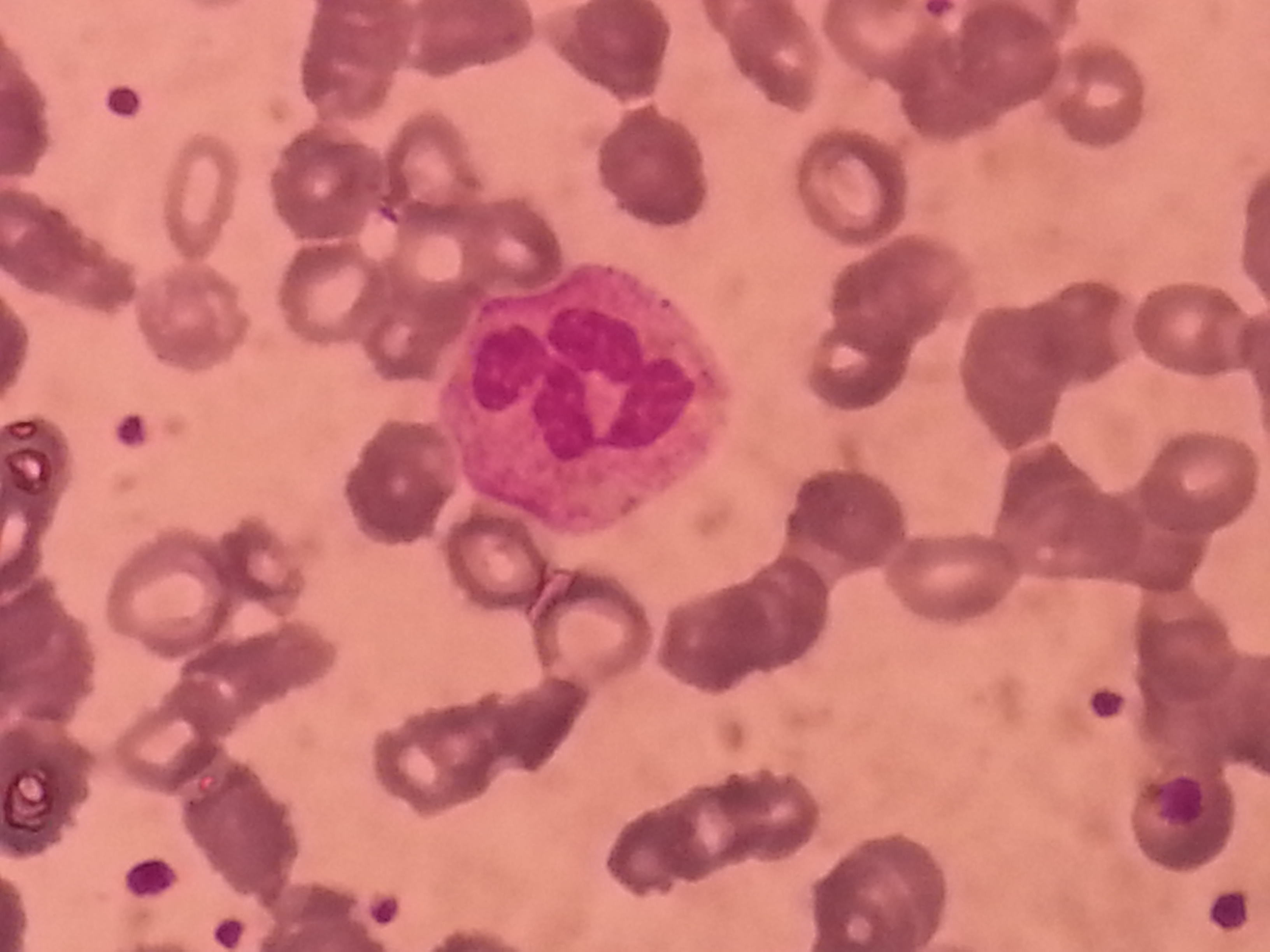 Mikroskopi av ett Wright-färgat blodutstryk: en neutrofil med flikad kärna i mitten, omgiven av många erytrocyter och små prickformade trombocyter.