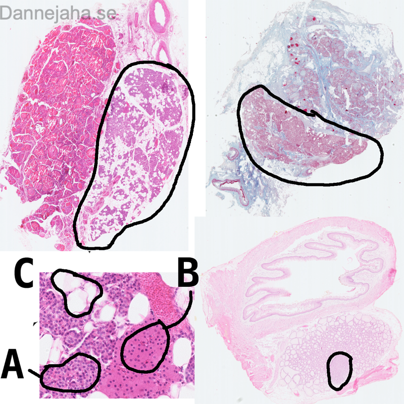 Parathyroidea struktur