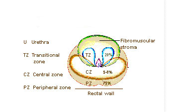 Diagram över prostatans zoner: perifer zon, central zon, transitionszon och periuretral vävnad runt urinröret.
