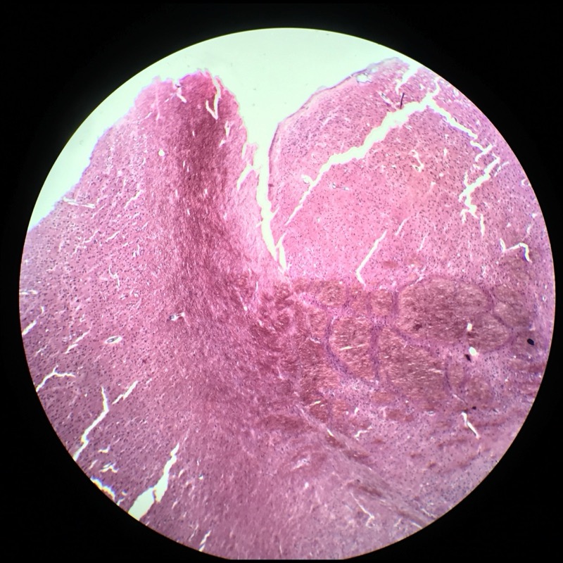 Cerebrum astroglia Cajals Guldsublimat - bild 1