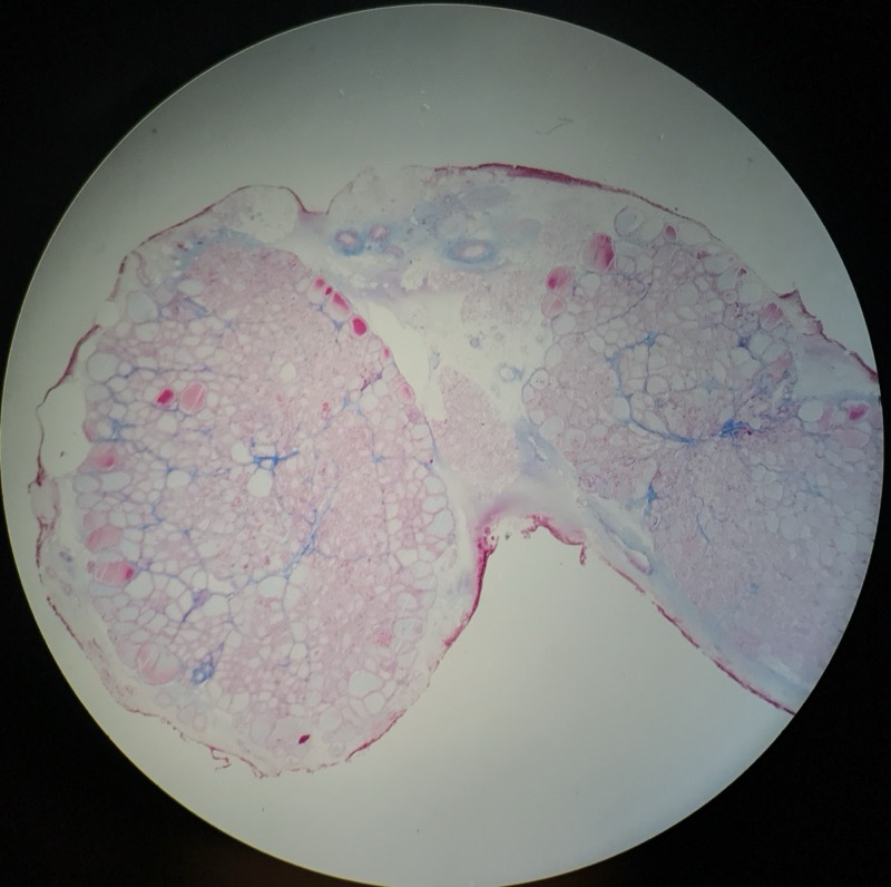 Thyroidea - bild 1