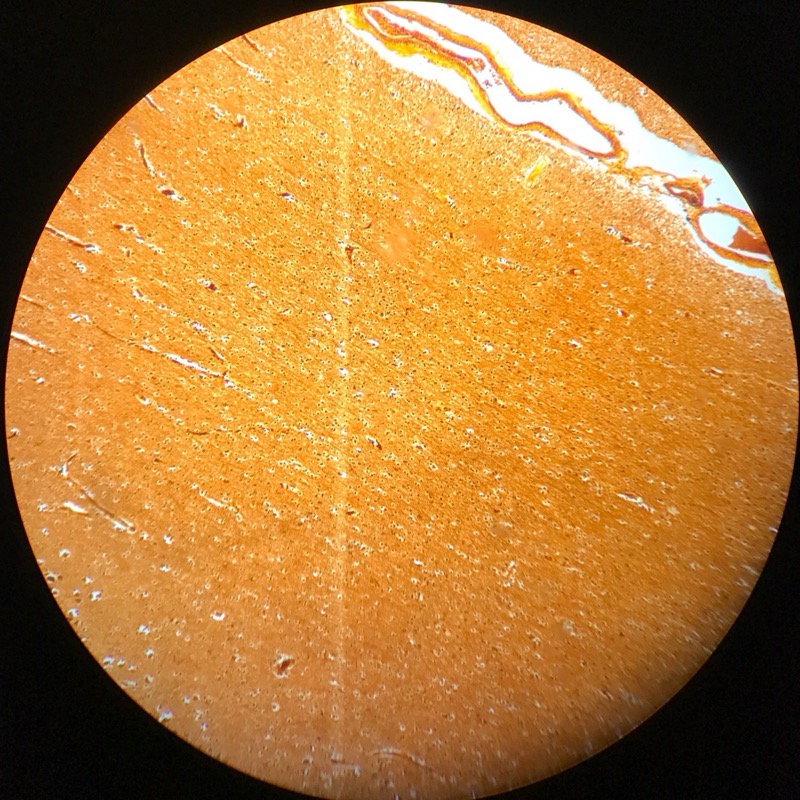 Cerebrum cortex , Silverfärgning - bild 5