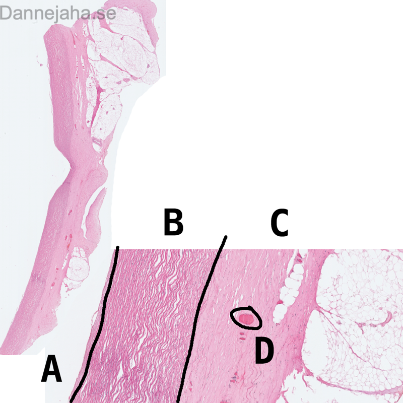 Elastisk artär - bild 1