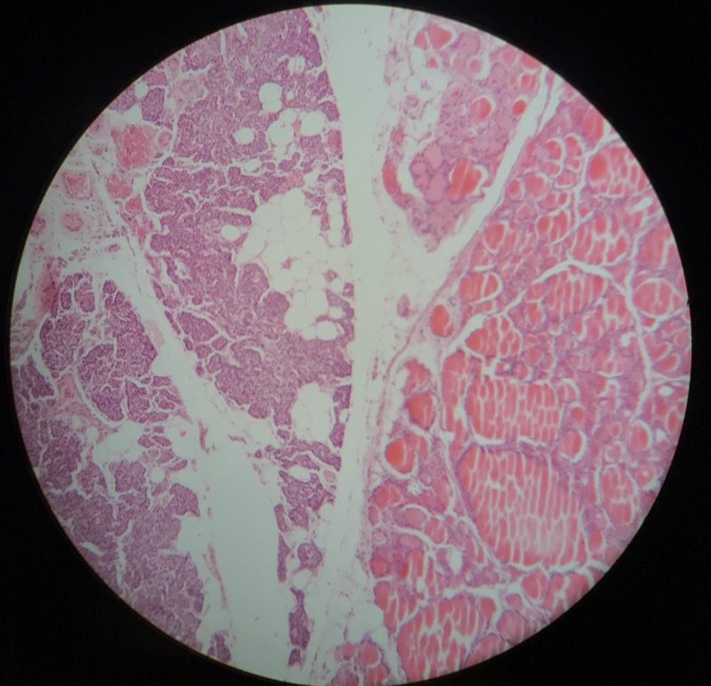 Parathyroidea - bild 2