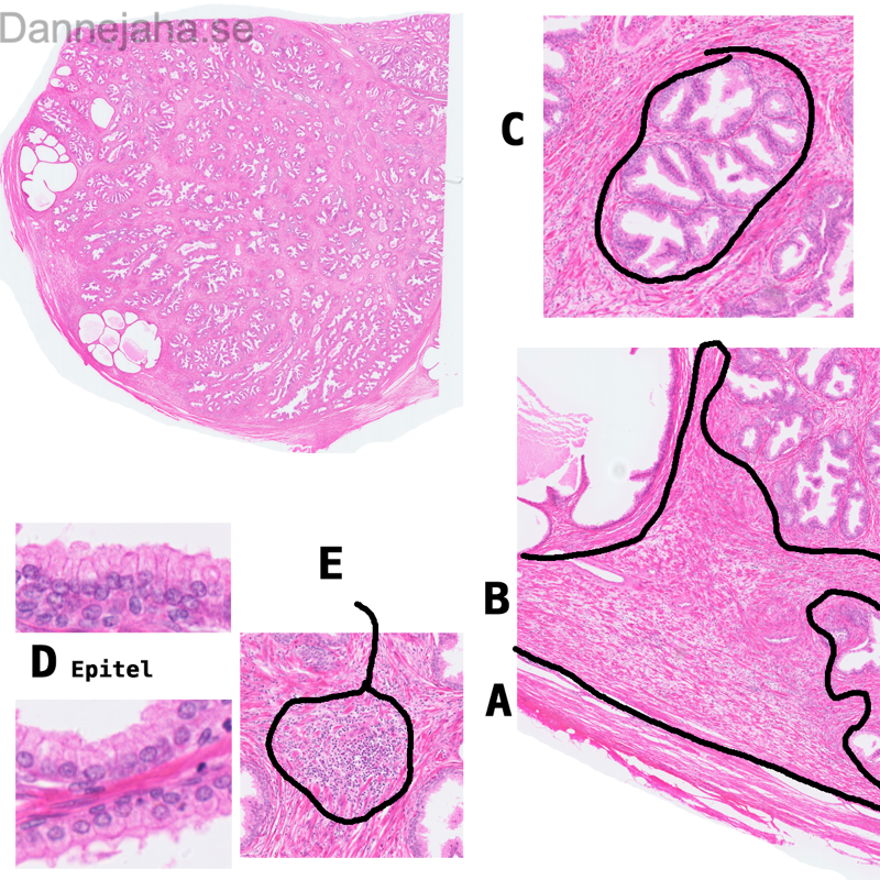 Prostata - bild 1