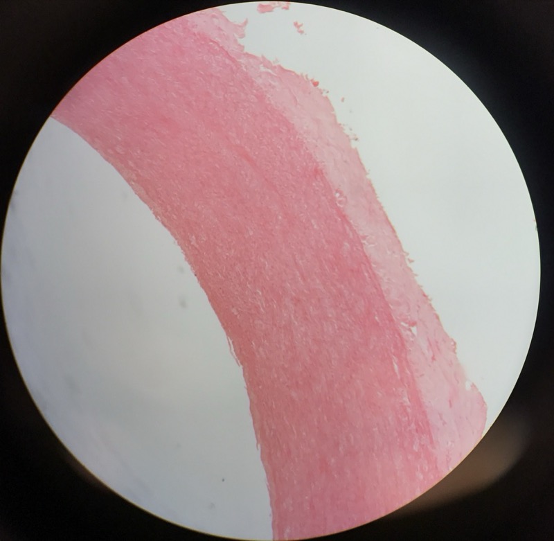 Aorta - bild 3