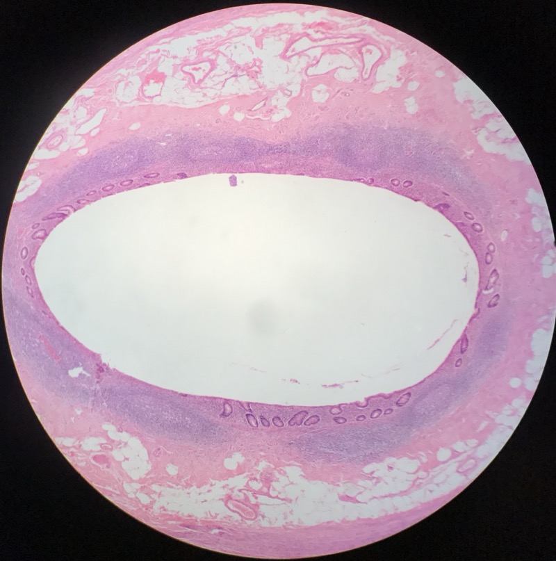 Appendix - bild 1