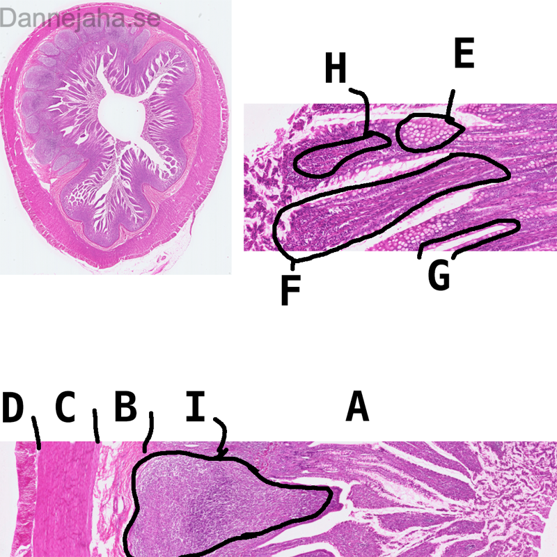 Ileum - bild 6