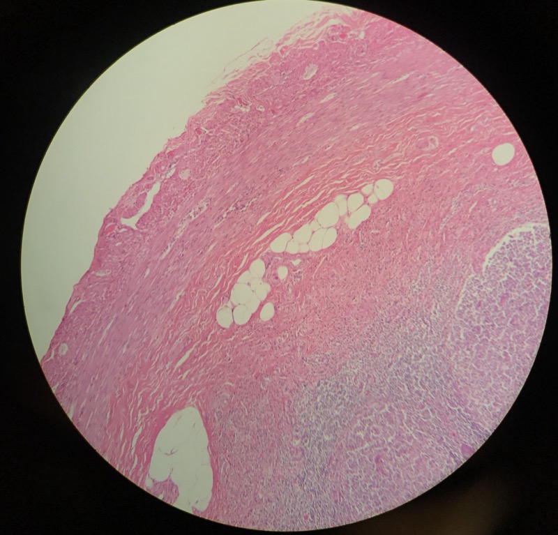 Appendix - bild 6