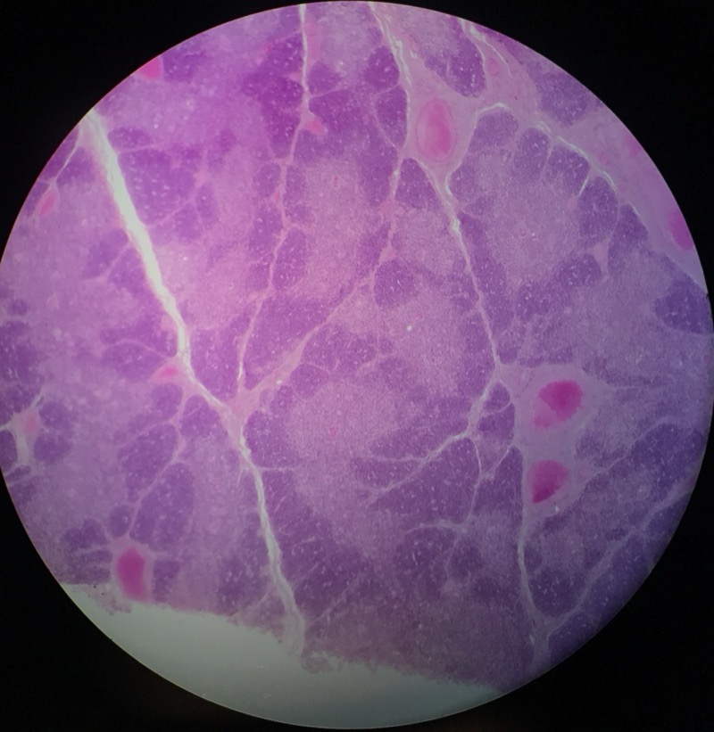 Thymus - bild 1