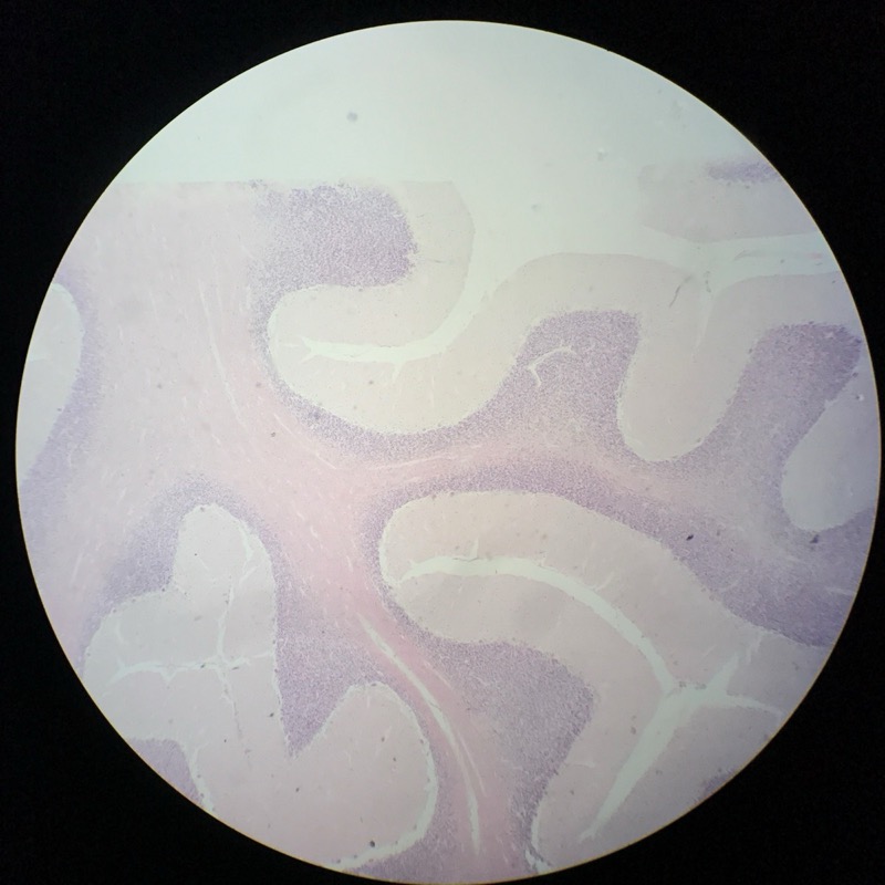 Cerebellum cortex - bild 3