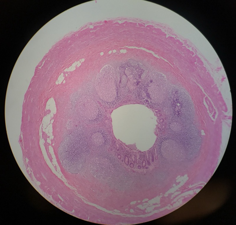 Appendix - bild 4