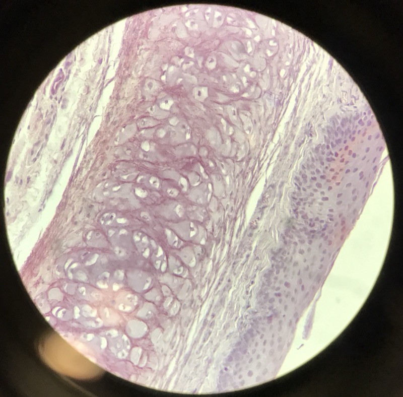 Elastiskt Brosk Epiglottis - bild 2