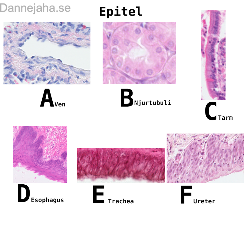 Epiteltyper diagram