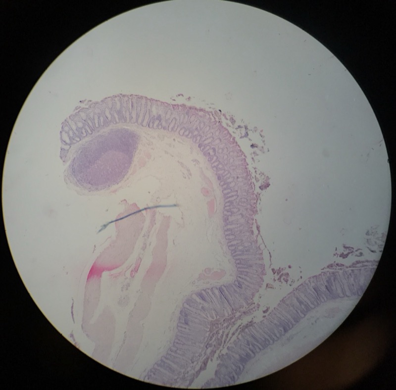 Colon - bild 2