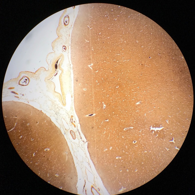 Cerebrum cortex , Silverfärgning - bild 2