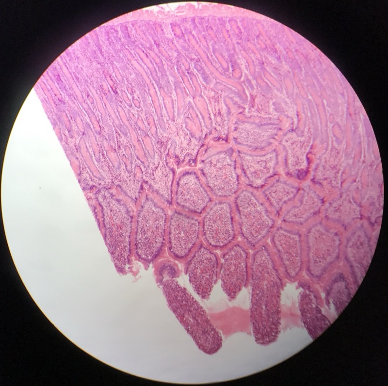 Duodenum - bild 2