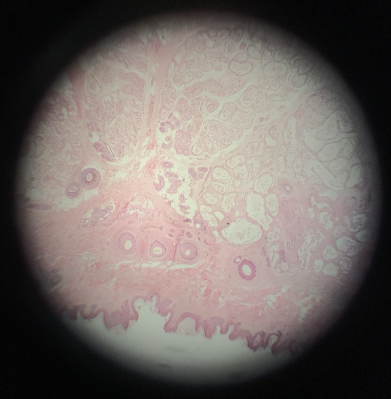 Hud pigmenterad - bild 1