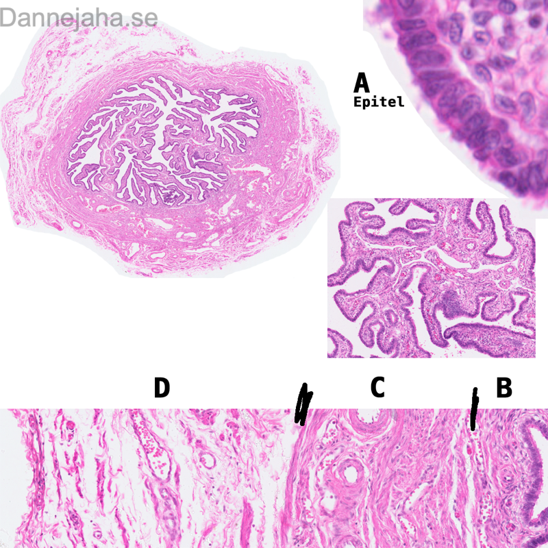 Tuba uterina - bild 1
