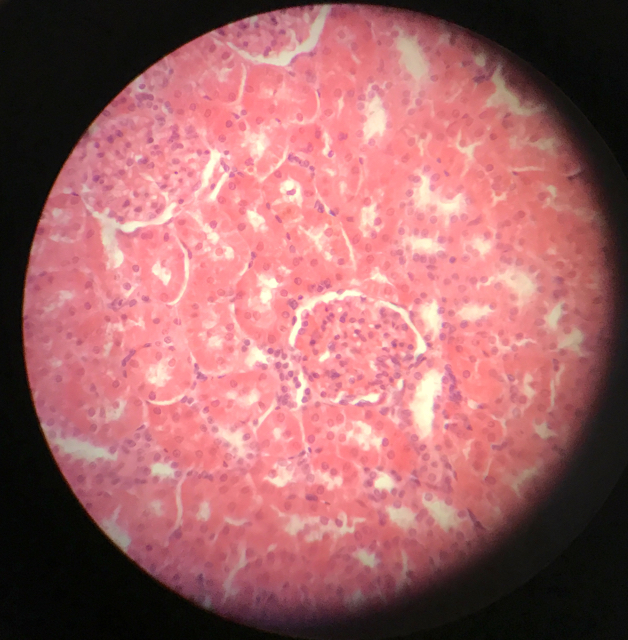 Njure - cortex och medulla - bild 8