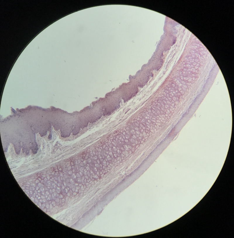 Elastiskt Brosk Epiglottis - bild 3