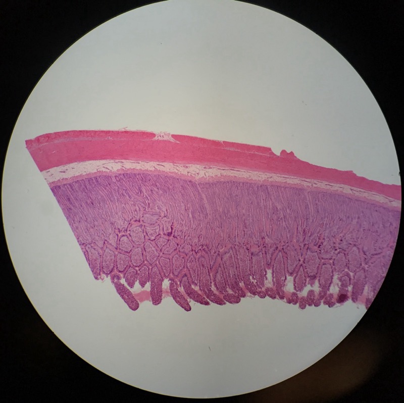 Duodenum - bild 5