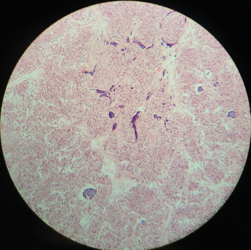 Epifys - bild 3
