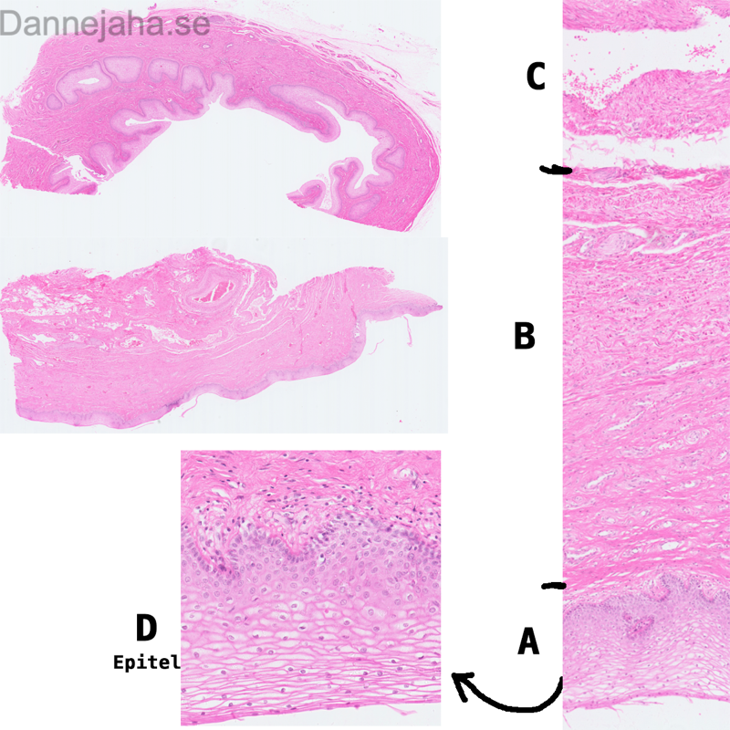Vagina - bild 1