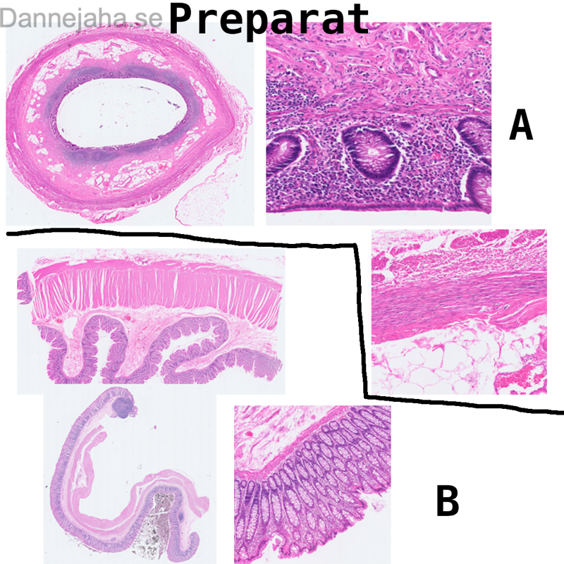 Jejunum - bild 3