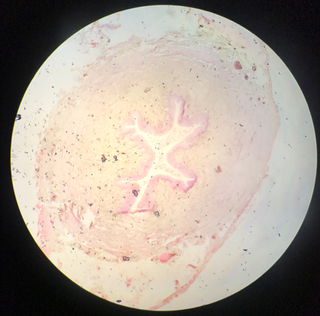Ureter - bild 1