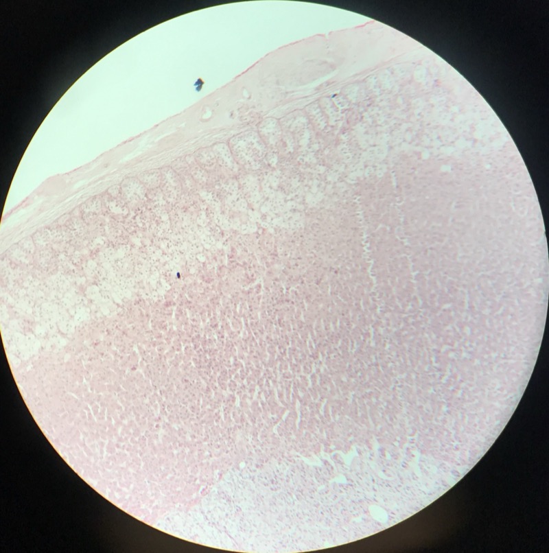 Glandula Suprarenalis (Binjure) - bild 2