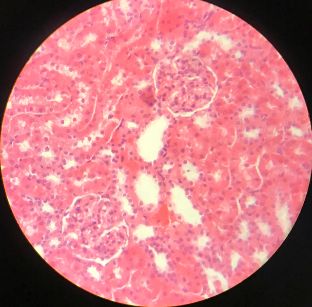 Njure - cortex och medulla - bild 9