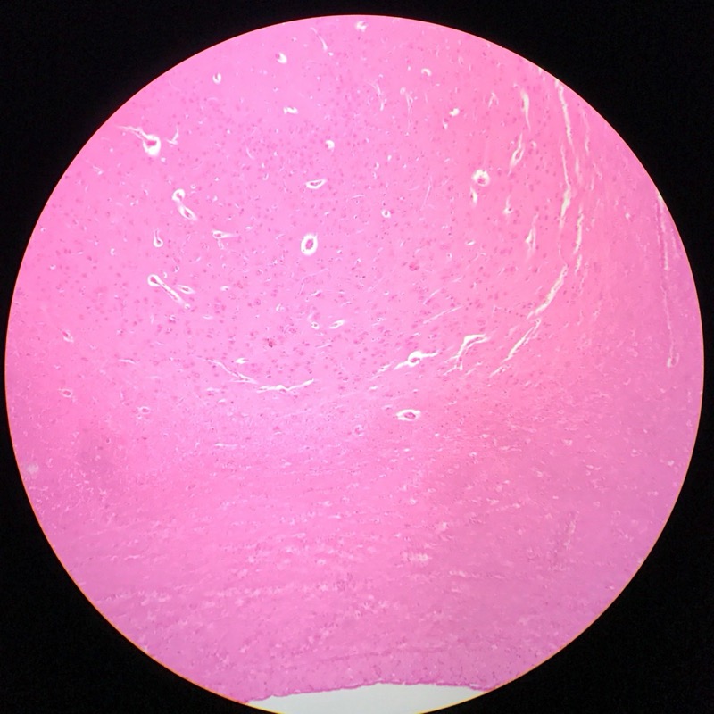 Cerebrum Cortex - bild 5