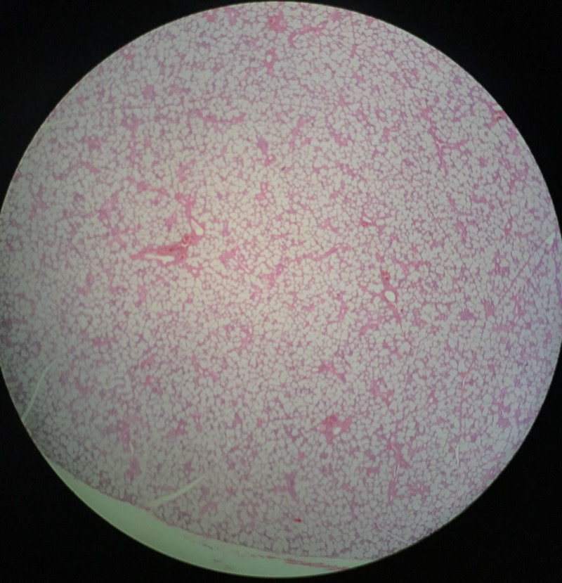 Glandula Sublingualis - bild 1