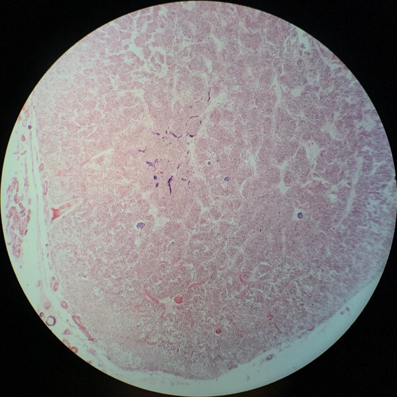 Epifys - bild 1
